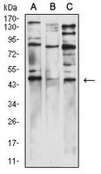 Wilms Tumor 1 Mouse Monoclonal Antibody