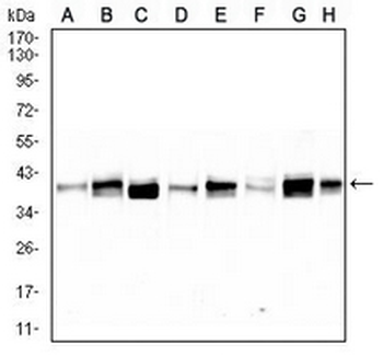 TRBC1 Mouse Monoclonal Antibody