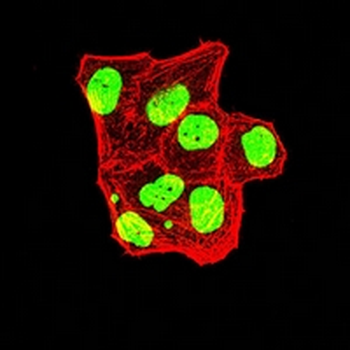 TRBC1 Mouse Monoclonal Antibody