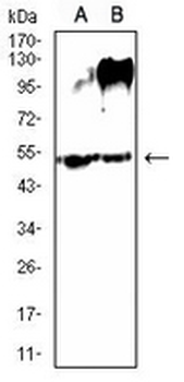 SLC7A3 Mouse Monoclonal Antibody