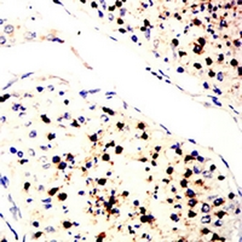 SLC7A3 Mouse Monoclonal Antibody