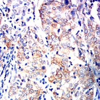 Siglec 15 Mouse Monoclonal Antibody