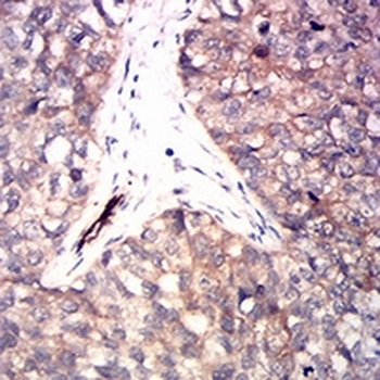 RRM1 Mouse Monoclonal Antibody