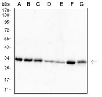 RPA2 Mouse Monoclonal Antibody