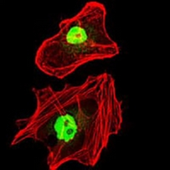 RPA1 Mouse Monoclonal Antibody