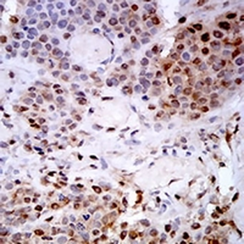 PSMC3 Mouse Monoclonal Antibody