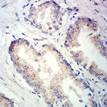 Prosaposin Mouse Monoclonal Antibody