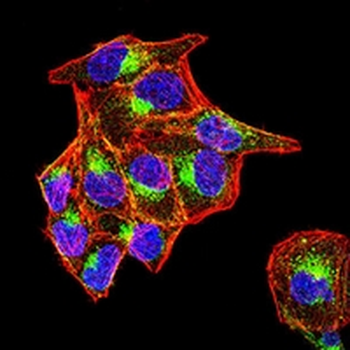 Prosaposin Mouse Monoclonal Antibody
