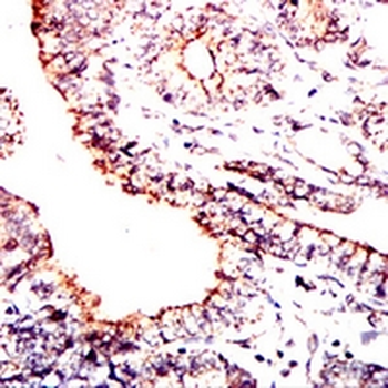 PDHA1 Mouse Monoclonal Antibody