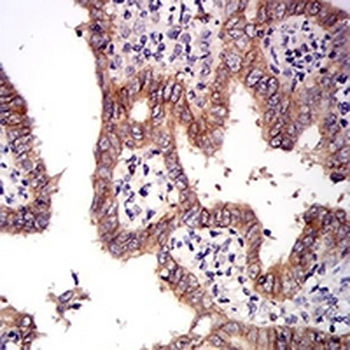 c-Met Mouse Monoclonal Antibody