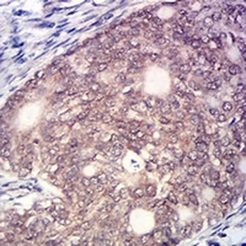 KAT7 Mouse Monoclonal Antibody
