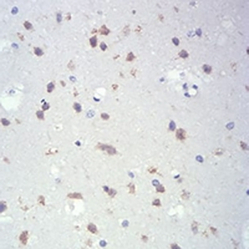 IL-28A Mouse Monoclonal Antibody