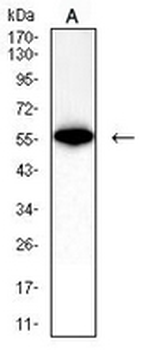 IFNAR1 Mouse Monoclonal Antibody