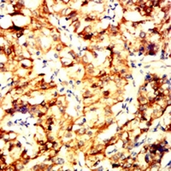 IFNAR1 Mouse Monoclonal Antibody