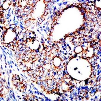 GRP75 Mouse Monoclonal Antibody