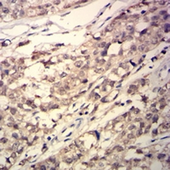 GSTP1 Mouse Monoclonal Antibody