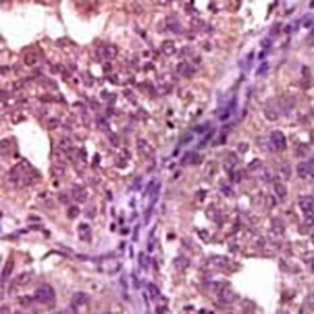 EPHA1 Mouse Monoclonal Antibody