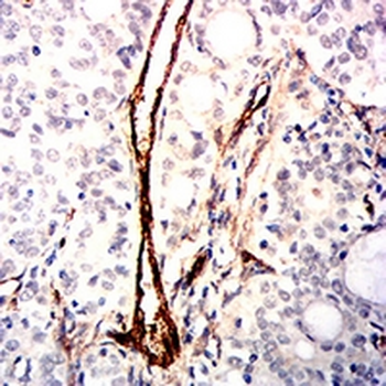CD105 Mouse Monoclonal Antibody