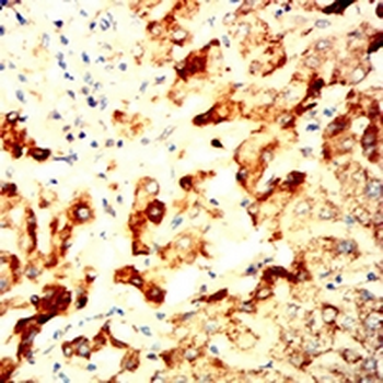 EIF2B3 Mouse Monoclonal Antibody