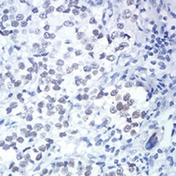 DDX5 Mouse Monoclonal Antibody