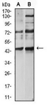 CD183 Mouse Monoclonal Antibody