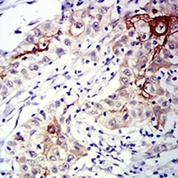 CD183 Mouse Monoclonal Antibody