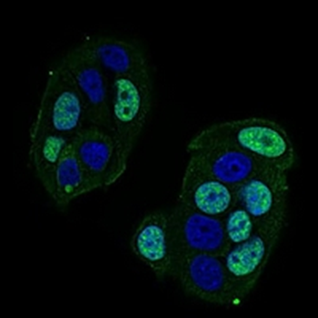 CTNNBL1 Mouse Monoclonal Antibody