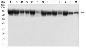 Beta-catenin Mouse Monoclonal Antibody