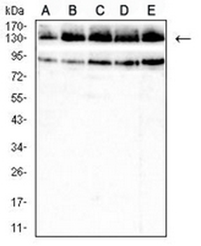 Collagen 2 alpha 1 Mouse Monoclonal Antibody