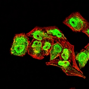 Collagen 2 alpha 1 Mouse Monoclonal Antibody