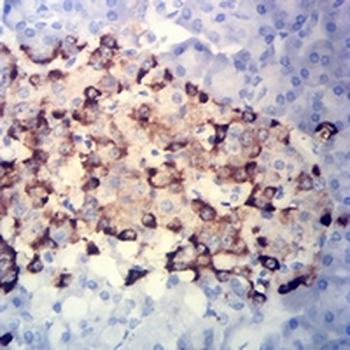 Chromogranin A Mouse Monoclonal Antibody