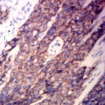 CD99 Mouse Monoclonal Antibody