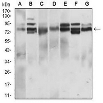 CD22 Mouse Monoclonal Antibody