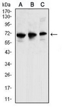 CCR6 Mouse Monoclonal Antibody
