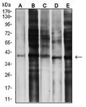 CCR5 Mouse Monoclonal Antibody
