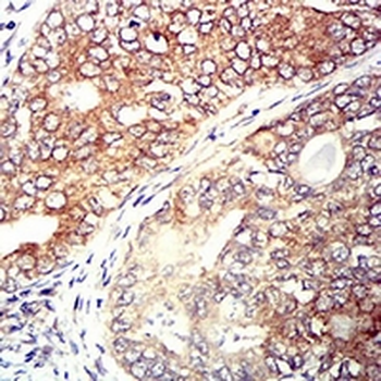 CCR5 Mouse Monoclonal Antibody