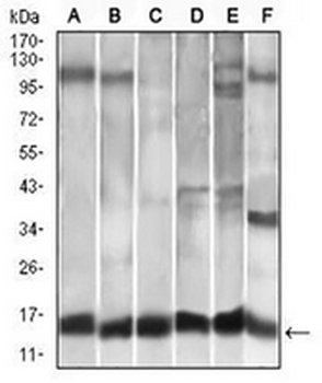CCL2 Mouse Monoclonal Antibody