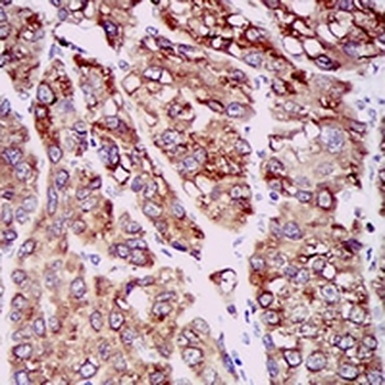 CCL2 Mouse Monoclonal Antibody