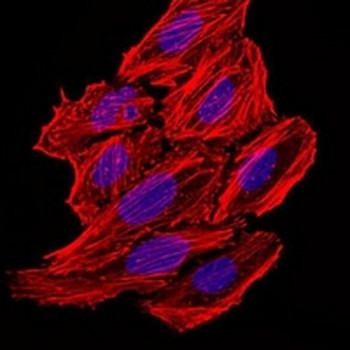 CCL2 Mouse Monoclonal Antibody