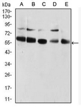 CBX2 Mouse Monoclonal Antibody