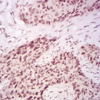 CBX2 Mouse Monoclonal Antibody