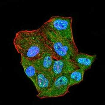 CBX2 Mouse Monoclonal Antibody