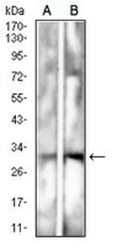 CD157 Mouse Monoclonal Antibody