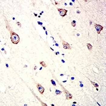CD157 Mouse Monoclonal Antibody