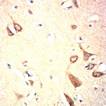 B4GALNT1 Mouse Monoclonal Antibody
