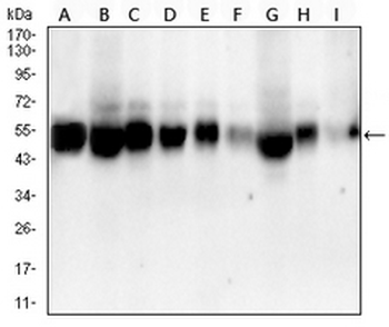 ALDH2 Mouse Monoclonal Antibody