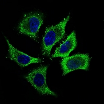 ALDH2 Mouse Monoclonal Antibody