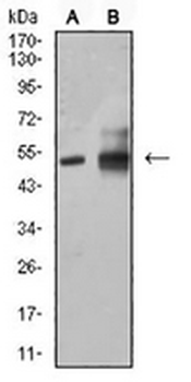 ALDH1A1 Mouse Monoclonal Antibody