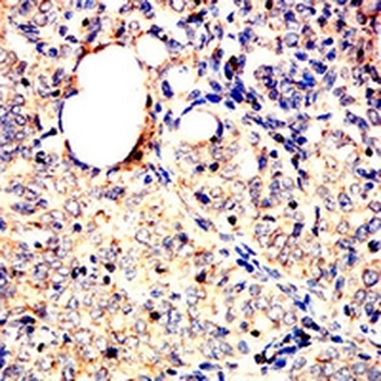 ACADM Mouse Monoclonal Antibody