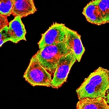 ACADM Mouse Monoclonal Antibody